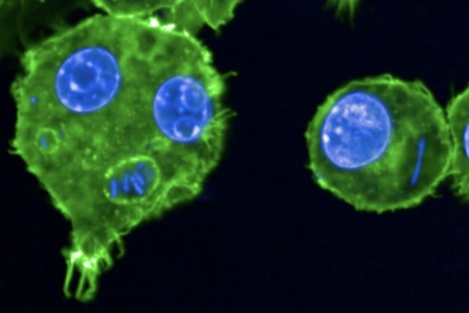 Des macrophages infectés par la bactérie Yersinia pestis photographiés en 2024 sur un cliché publié par l'Institut Pasteur, à Paris le 27 mai 2025 ( Institut Pasteur / Anne DERBISE )