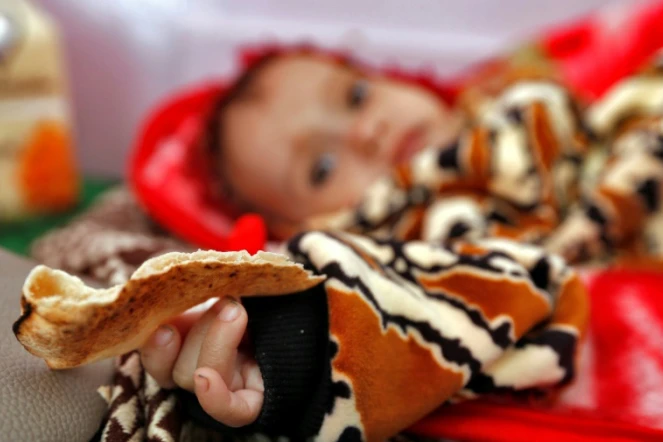Un enfant yéménite souffrant de malnutrition, dans un hôpital de Sanaa, le 22 novembre 2017