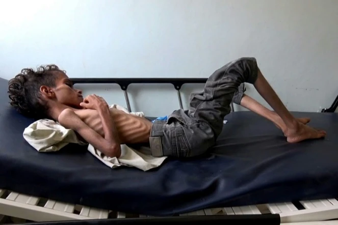 Un Yéménite de 10 ans souffrant de famine à Taez au Yémen, le 19 novembre 2018
