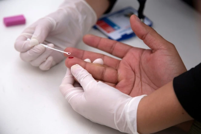 Un patient atteint du VIH, ayant bénéficié d'une greffe de cellules souches, est désormais "guéri", ce qui en fait le deuxième au monde à se remettre de cette maladie