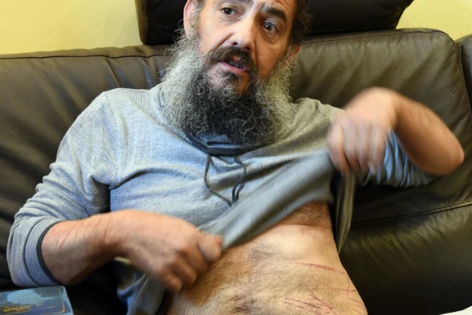 Photo prise le 19 novembre 2015 à son domicile de Tzion Saadoun, un enseignant d'une école juive à Marseille affirmant avoir été attaqué la veille, qui montre ses blessures 