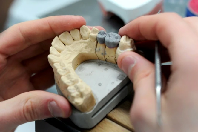 Un prothésiste travaille sur une dent en céramique. Parmi ce qui change au 1er avril: le plafonnement des prix de certaines prothèses dentaires