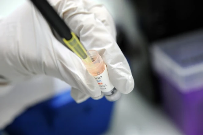 Les cellules cancéreuses perdent de petits fragments d'ADN en circulant dans le sang et ceux-ci peuvent être collectés et analysés en laboratoire pour décider de la thérapie à suivre