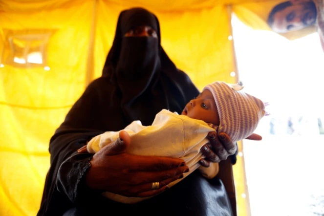 Une mère yéménite avec son enfant soupçonné d'être infecté par le choléra à Sanaa, le 9 juin 2017 
