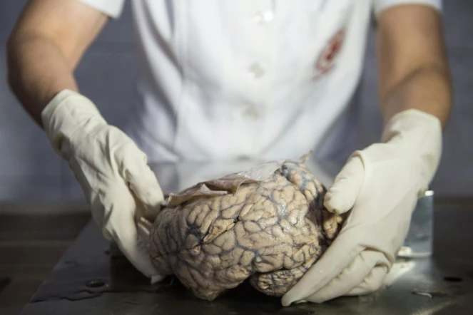 La doctoresse Diana Rivas manipule un cerveau humain extrait d'un bocal de formol au musée de neuropathologie de Lima, le 16 novembre 2016