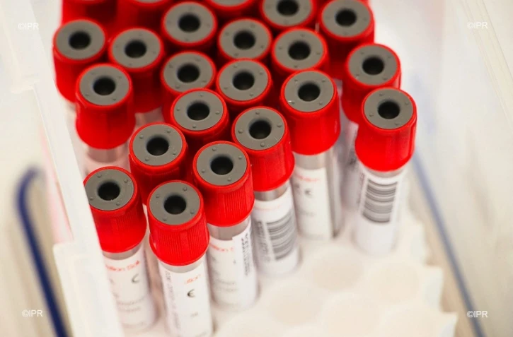 test coronavirus