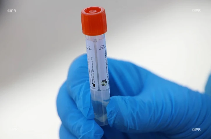 dépistage coronavirus 