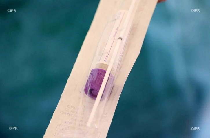 prélèvement clinique sainte clotilde 