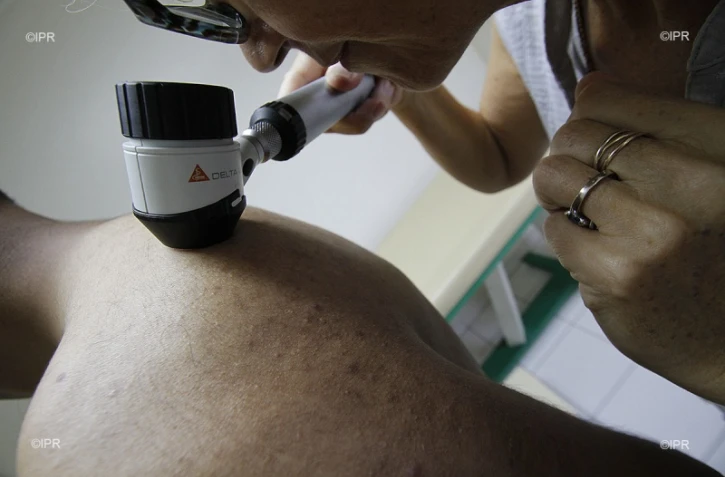 dépistage cancer de la peau 
