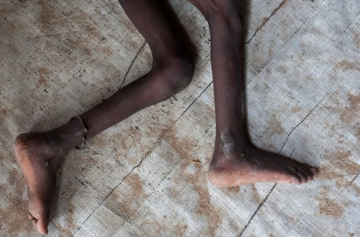 Enfants morts de faim AFP 