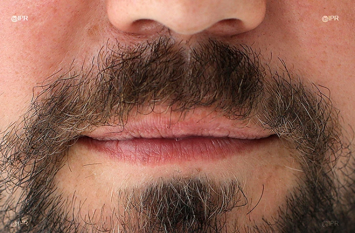 "Movember" : la moustache contre le cancer