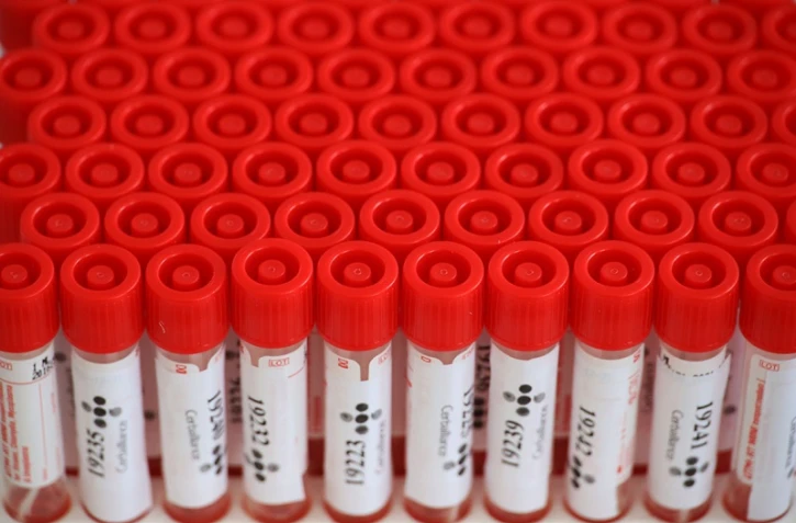 test coronavirus 