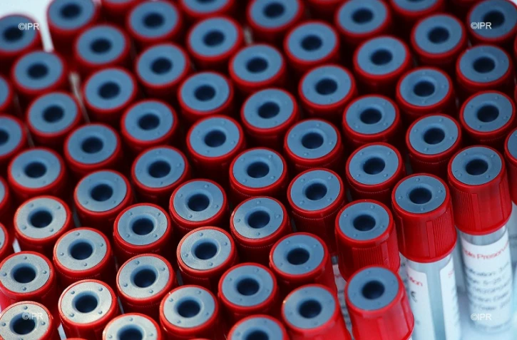 test coronavirus 