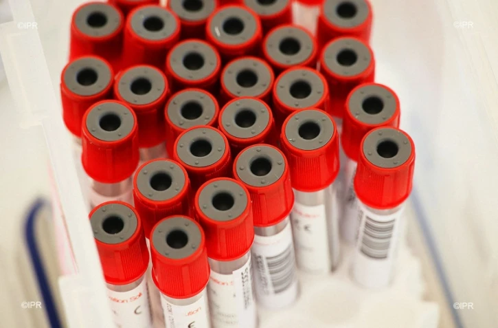 test coronavirus 