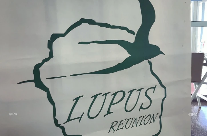 Lupus