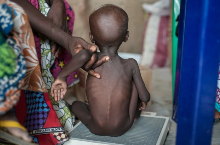 Une fillette souffrant de malnutrition le 30 juin 2016 à Maiduguri au Nigeria