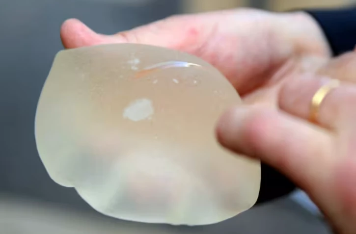 Une prothèse mammaire PIP défectueuse, le 10 juin 2010 à Marseille ( AFP / GERARD JULIEN )