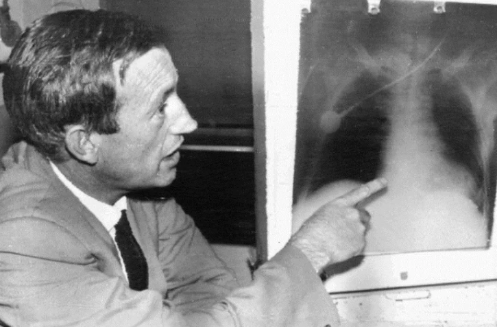 Christiaan Barnard le chirurgien sud-africain qui a pratiqué la première greffe du c?ur montre une radiographie du receveur Louis Washkansky, le 1er décembre 1992 au Cap
