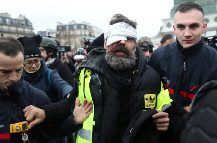 Jérôme Rodrigues, porte-parole des Gilets jaunes à Paris le 26 janvier 2019