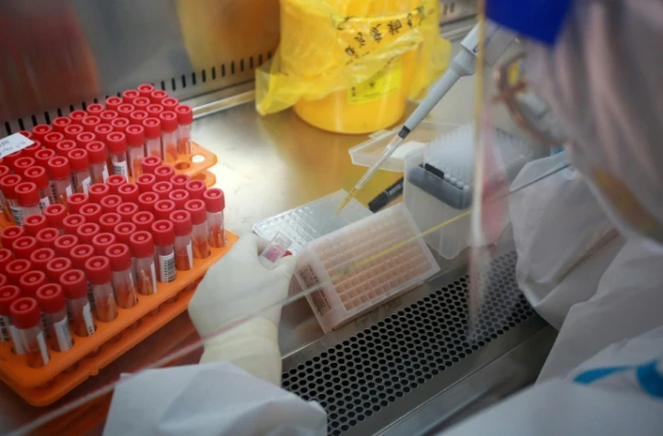 Près de 6 millions de tests Covid ont été effectués entre le 9 et le 15 août 2021 en France, un record atteint sous l'effet de l'extension du pass sanitaire, selon les données officielles rendues publiques jeudi