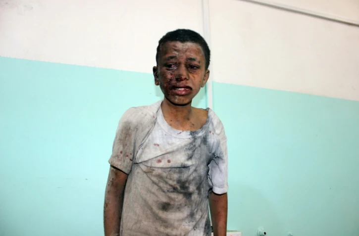 Un enfant yéménite attend d'être pris en charge dans un hôpital après avoir été blessé dans une frappe sur la province rebelle de Saada, le 9 août 2018