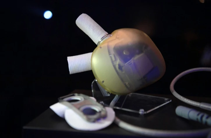 Un coeur artificiel fabriqué par la société de biotechnologie Carmat, à Paris, le 14 février 2017