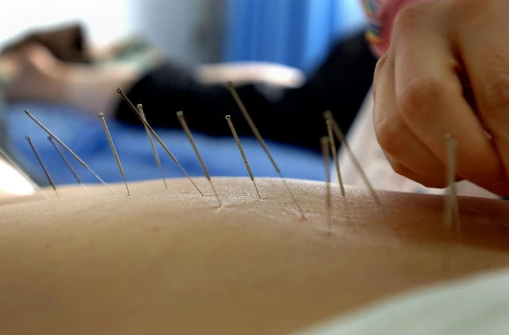 Seuls les médecins, sages-femmes et dentistes formés à l'acupuncture à l'université sont autorisés à pratiquer