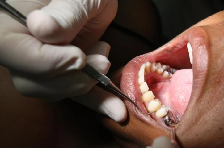 Dentiste