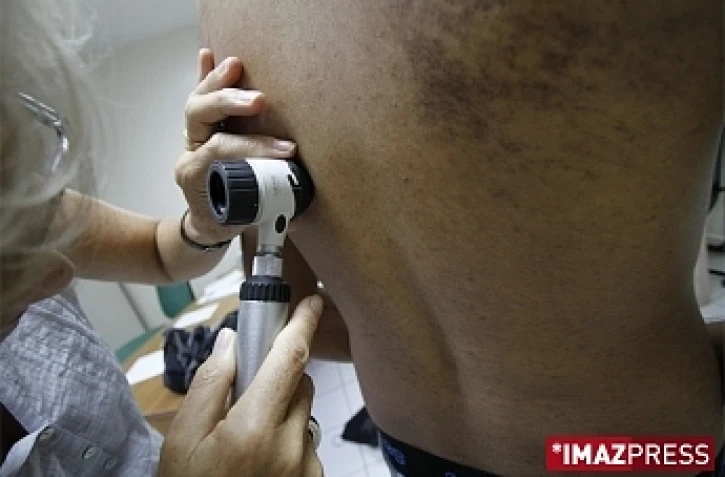 Consultation chez un dermatologue (photo archives)