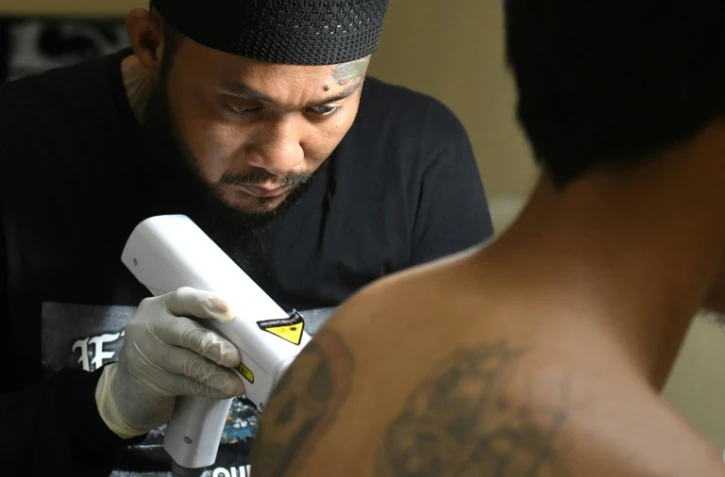 Sandi Widodo  travaille sur un client musulman qui souhaite effacer ses tatouages, le 18 avril 2018 à Jakarta, en Indonésie