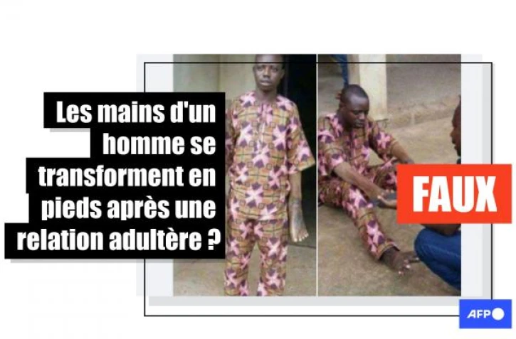   Cette photo montre un acteur pendant un tournage et non un homme victime d'une malédiction