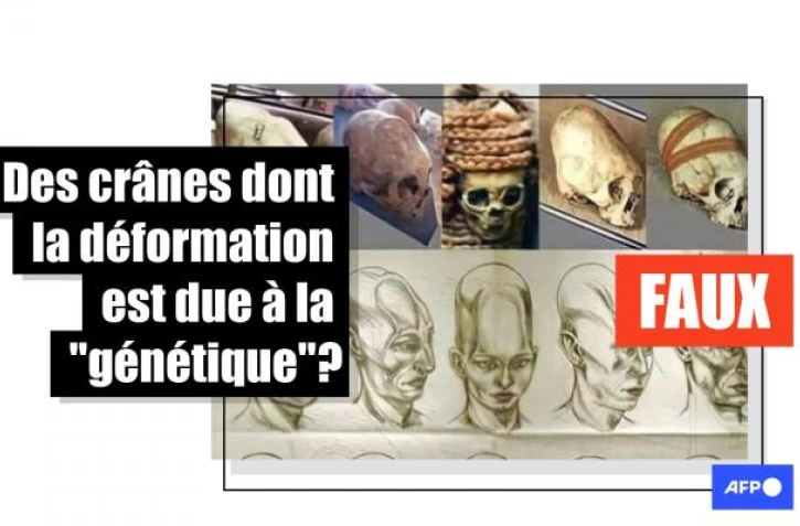   La forme de ces crânes retrouvés au Pérou est due à une pratique culturelle et n'a rien à voir avec la génétique
