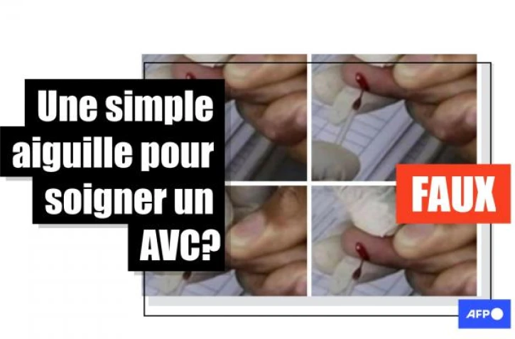   Non, se piquer les doigts avec une aiguille ne sauve pas d&rsquo;un AVC
