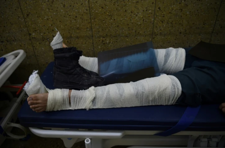 Un blessé afghan soigné dans un hôpital à Kaboul le 31 mai 2017