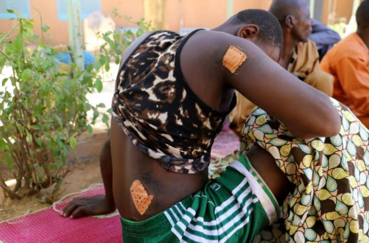 Un survivant d'une attaque jihadiste particuièrement meurtrière montre ses blessures à Ouallam, au Niger, le 9 janvier 2021.