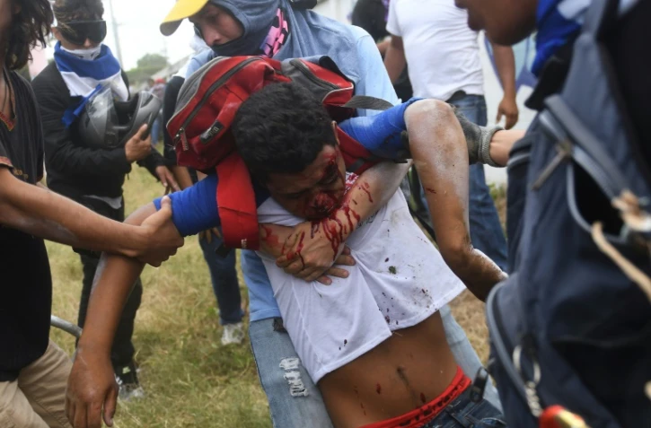 Un manifestant nicaraguayen défilant contre le gouvernement de Daniel Ortega blessé lors d'affrontements à Managua, le 30 juin 2018.