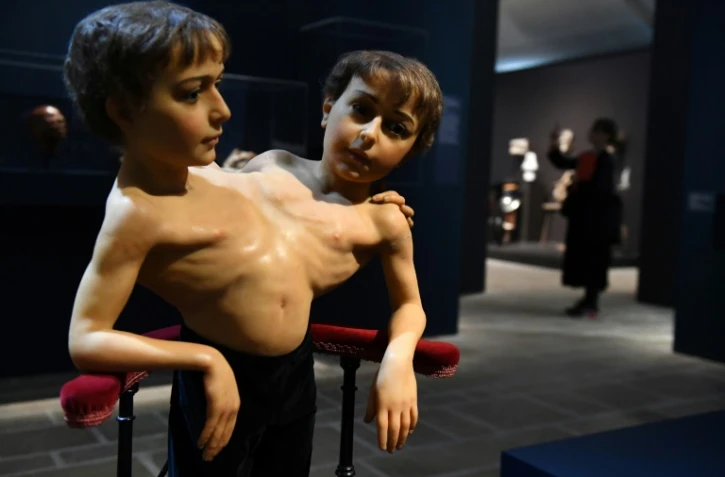 Une sculpture en cire des siamois Giacomo et Giovanni-Battista Tocci présentée lors de l'exposition "Cabinets de curiosité" au Fonds Hélène et Edouard Leclerc de Landerneau, en France