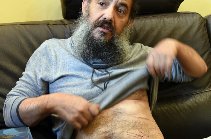 Photo prise le 19 novembre 2015 à son domicile de Tzion Saadoun, un enseignant d'une école juive à Marseille affirmant avoir été attaqué la veille, qui montre ses blessures