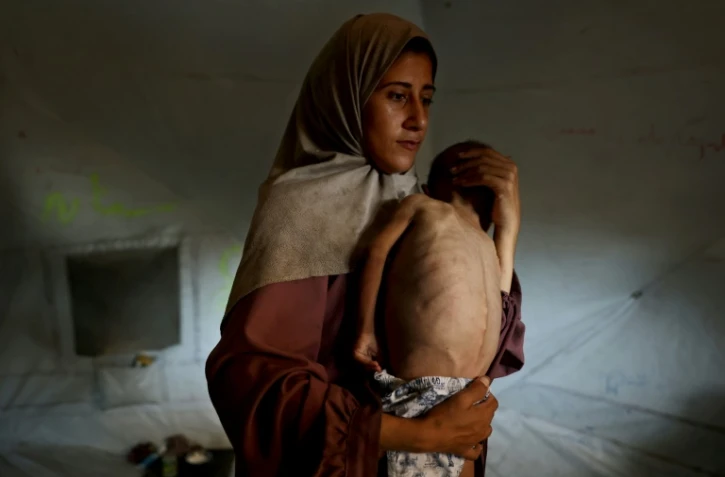 Hidaya, une mère palestinienne de 31 ans, porte son fils malade de 18 mois, Mohammed al-Mutawaq, qui présente des signes de malnutrition, au camp de réfugiés d'Al-Shati, à l'ouest de la ville de Gaza, le 24 juillet 2025