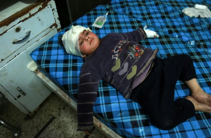 Un enfant syrien est soigné dans un hôpital de Douma, dans la Ghouta orientale, le 3 mars 2018