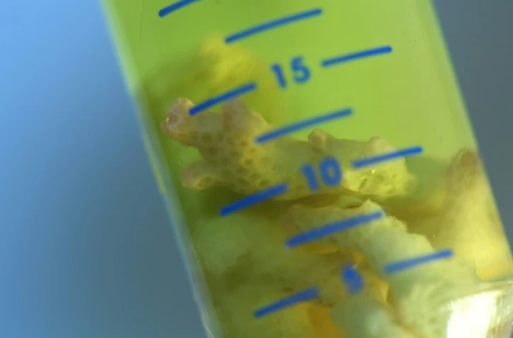 Morceaux de coraux dans un tube au Genoscope d'Evry, près de Paris le 9 novembre 2017