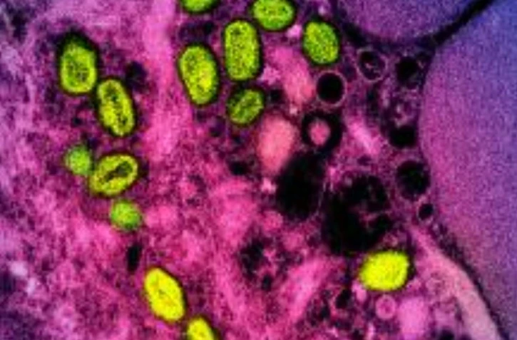 Image de l'Institut américain des allergies et maladies infectieuses (NIAID) de Bethesda montrant le Mpox