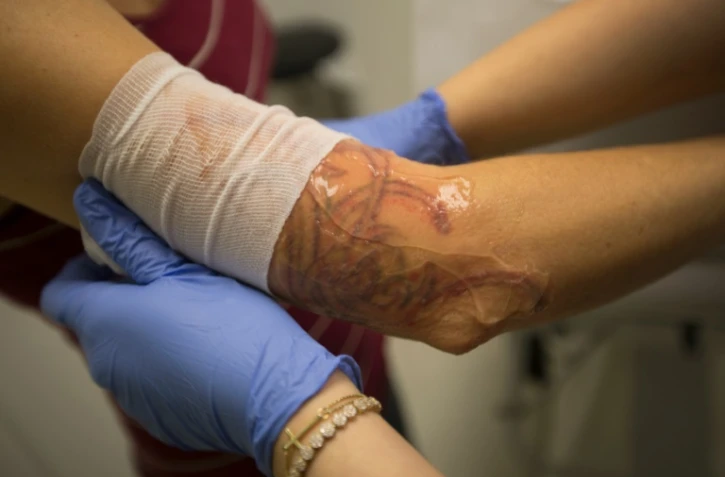 Les études montrent que de plus en plus d'Américains se font tatouer (un adulte sur cinq selon l'une d'elles), mais qu'ils sont aussi de plus en plus nombreux à le regretter
