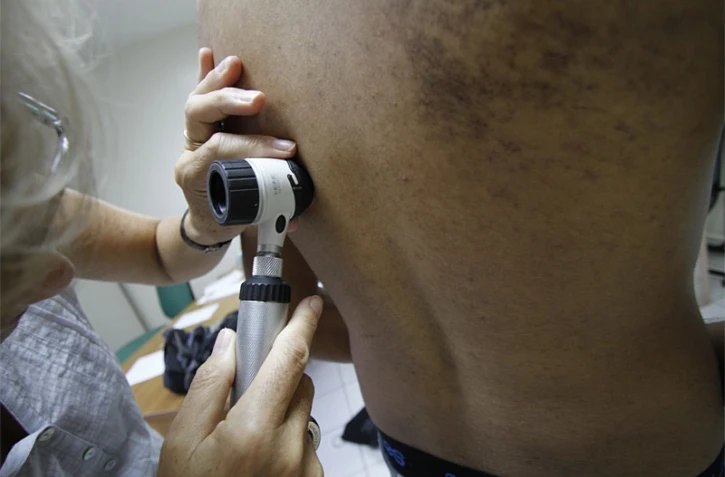 Jeudi 27 Mai 2010
Consultation par un Dermatologue