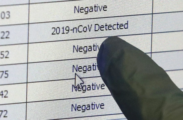 Coronavirus: entre cas réels et cas détectés, l'épidémie avance masquée