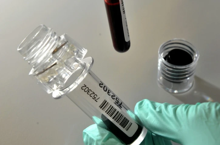 Depuis que le sport de compétition existe, les athlètes comptent sur les fortifiants les plus divers -certains peu ragoûtants, d'autres carrément dangereux- pour remporter des médailles, sans se soucier de leur santé