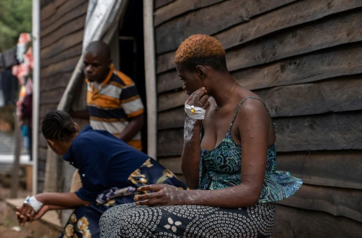 Une patiente atteinte du mpox attend à l'hôpital de Kavumu, au nord de Bukavu, dans l'est de la RDC, le 24 août 2024