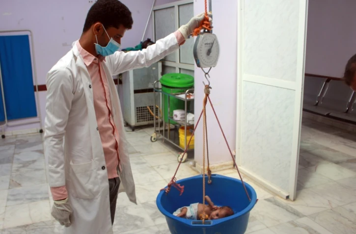 Un enfant souffrant de malnutrition est pesé dans un centre de santé de la province de Hajjah, dans le nord du Yémen en guerre, le 5 juillet 2020