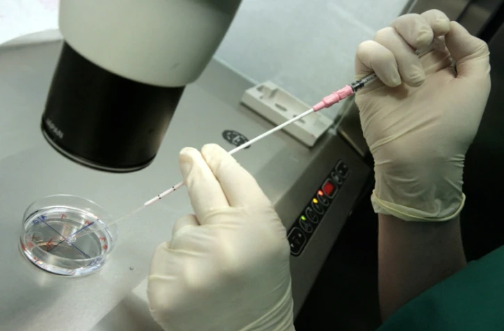 Un médecin effectue une manipulation dans une clinique spécialisée dans la procréation médicalement assistée, à Barcelone le 18 juin 2008