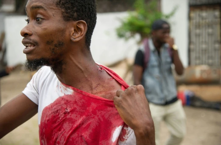 Un homme montre ses blessures, le 20 septembre 2016, près des locaux du principal parti d'opposition, à Kinshasa